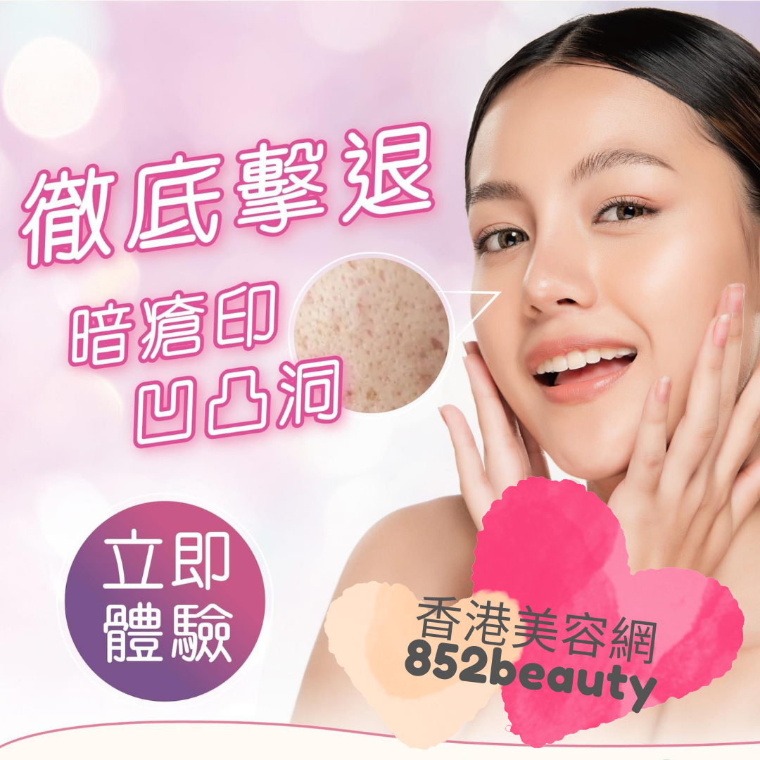 Latest Beauty Discount美容優惠 - 尖沙咀區] 全港首創TPS 去印去洞 $888試做優惠！ @ Hong Kong Beauty Salon